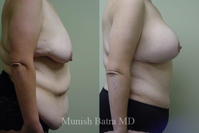 Before and After Image