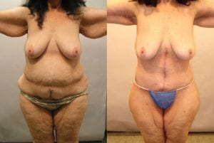 Before and After Image