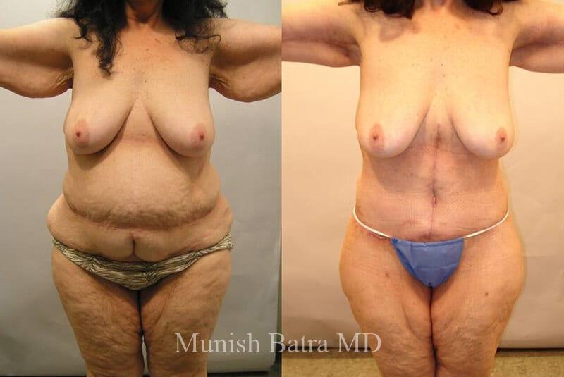 Before and After Image