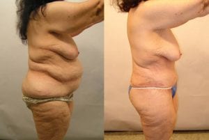 Before and After Image