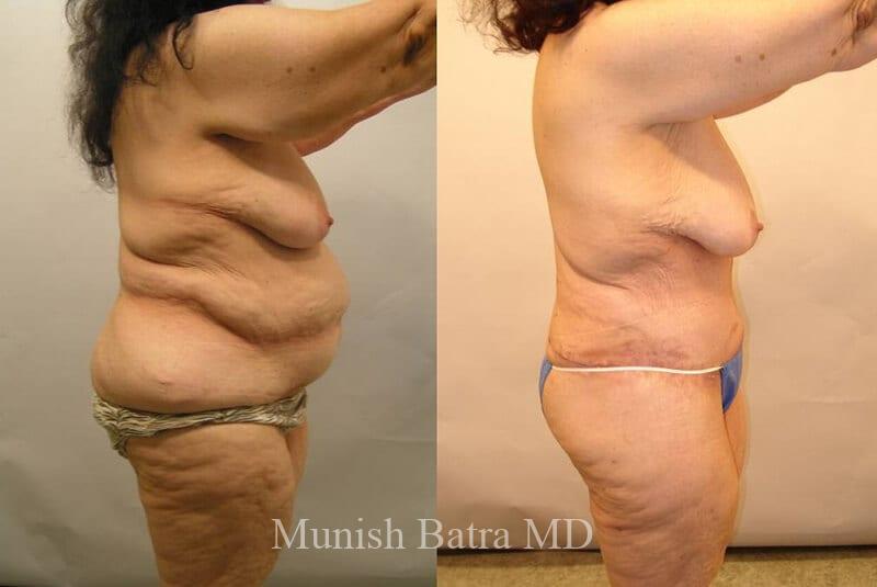 Before and After Image