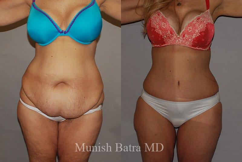 Before and After Image