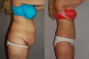 Before and After Image
