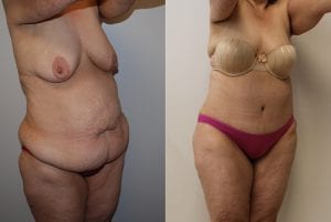 Before and After Image
