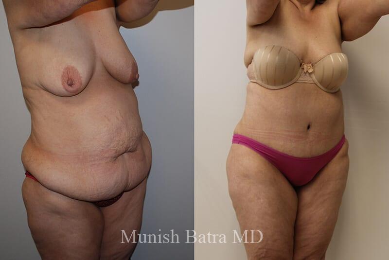 Before and After Image