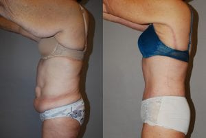 Before and After Image