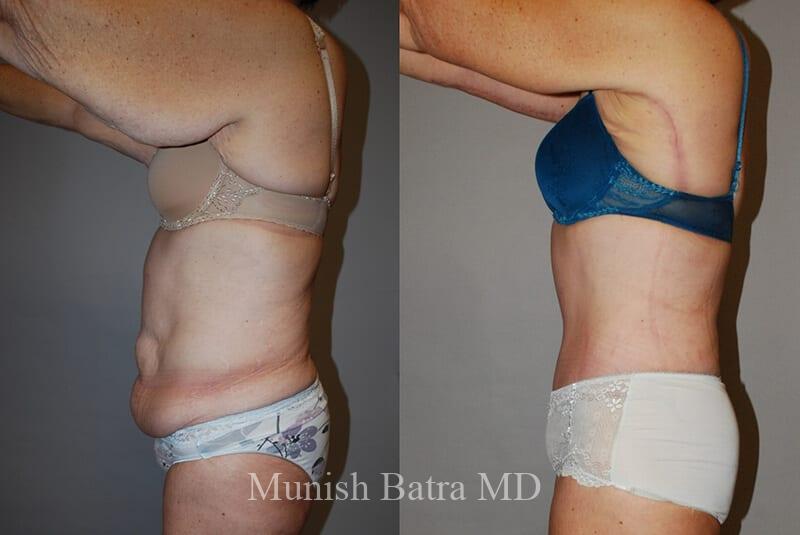 Before and After Image