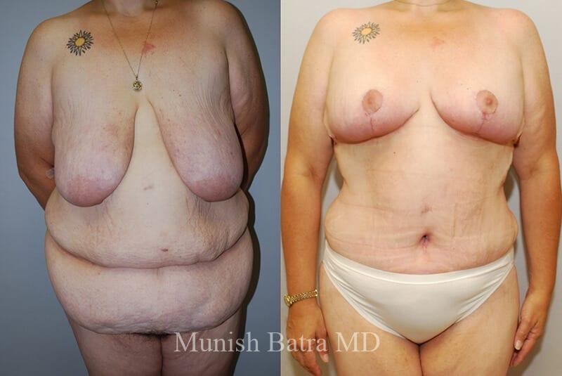 Before and After Image