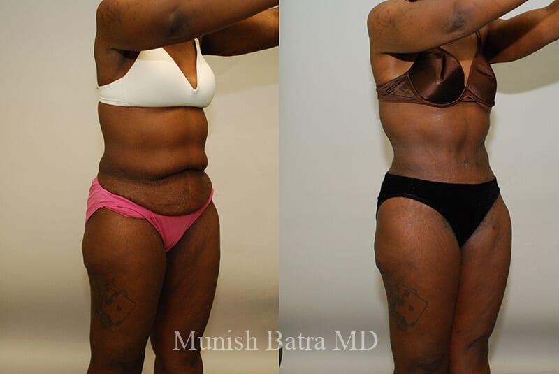 Before and After Image