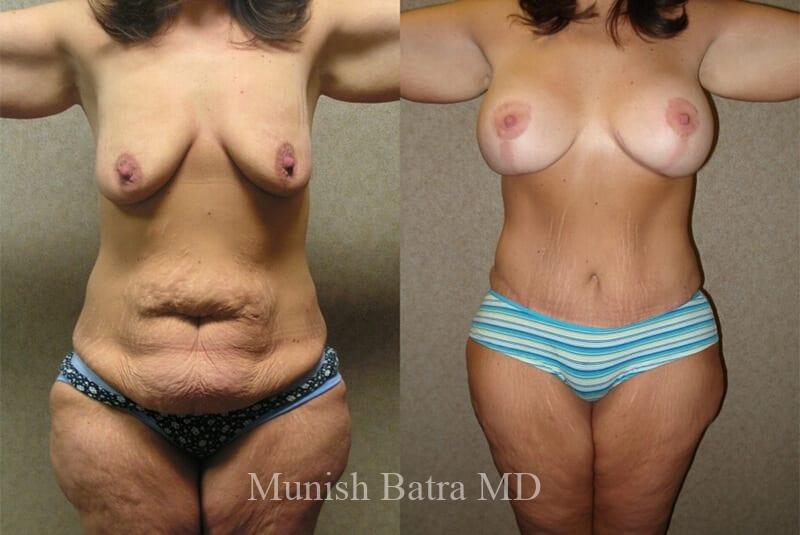 Before and After Image