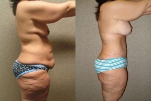 Before and After Image