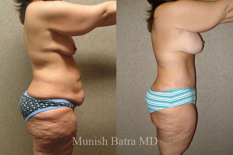 Before and After Image