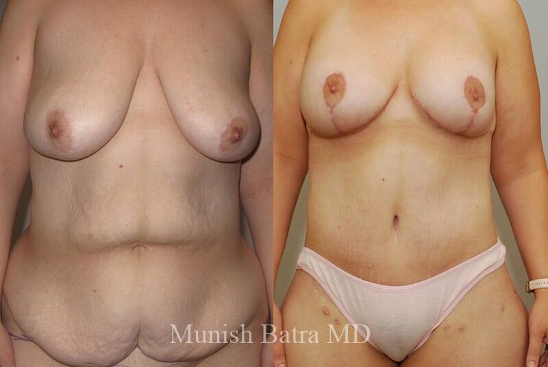 Before and After Image