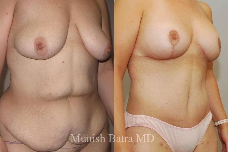 Before and After Image