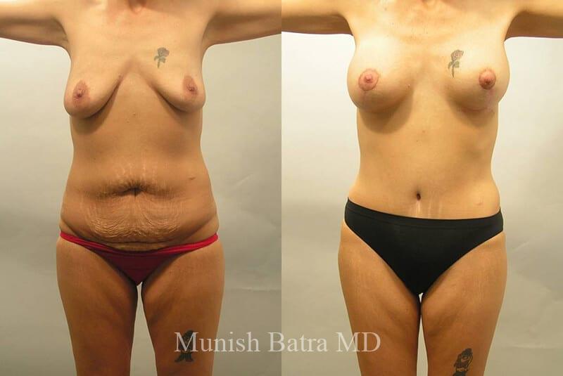 Before and After Image