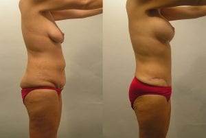 Before and After Image