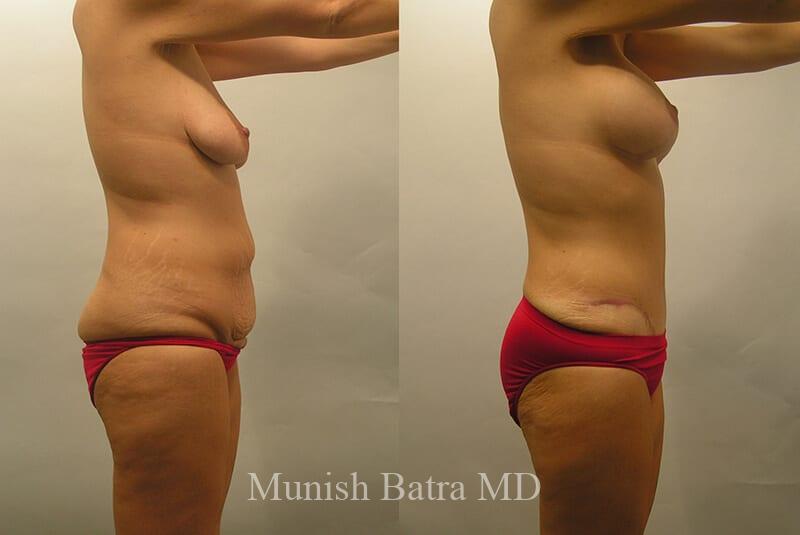 Before and After Image