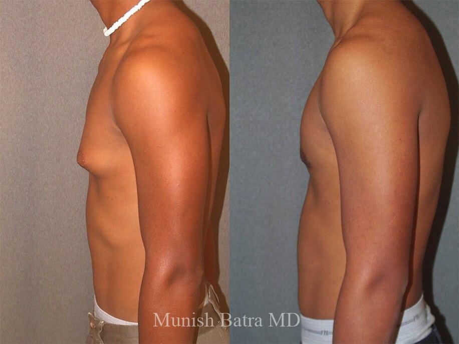Before and After Image