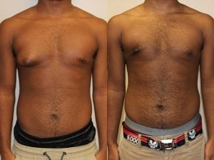 Before and After Image