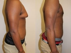 Before and After Image