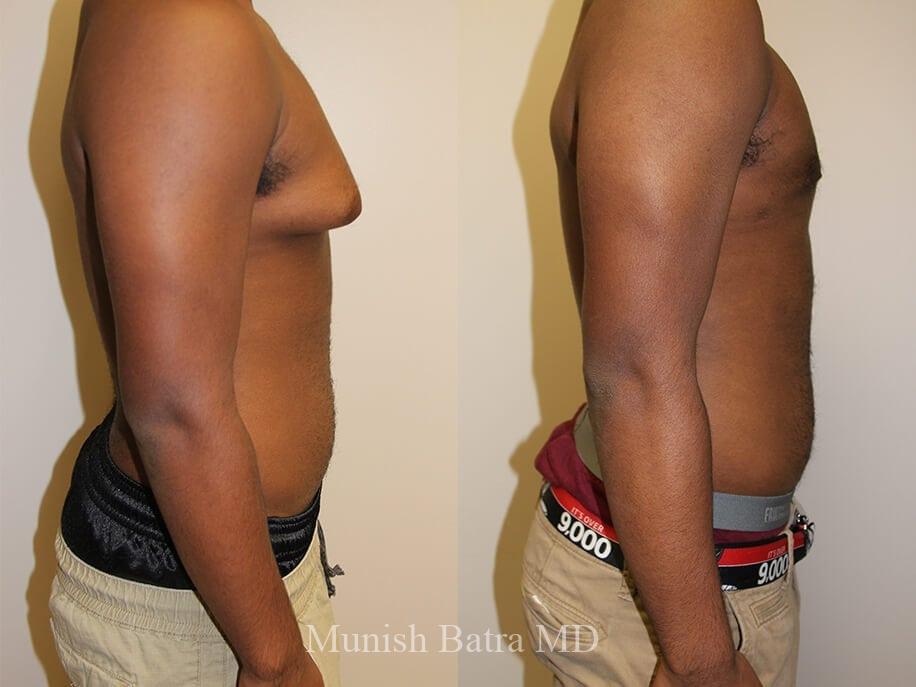 Before and After Image