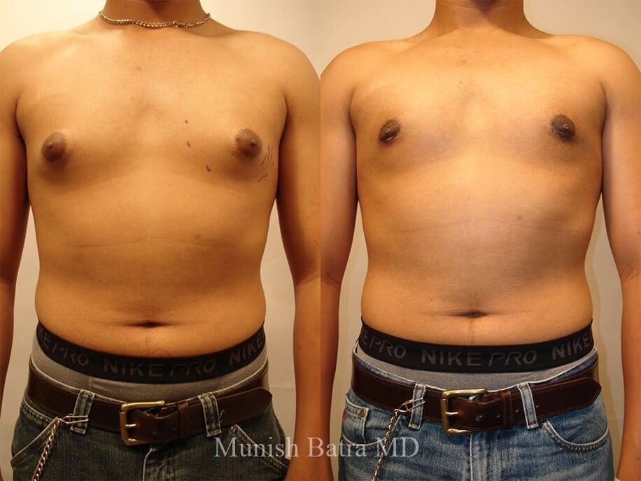 Before and After Image