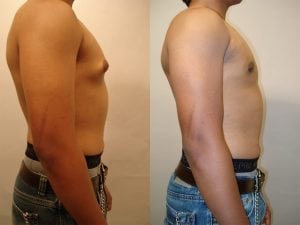 Before and After Image