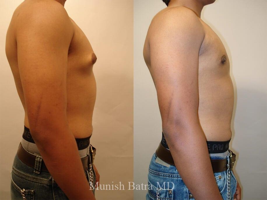 Before and After Image