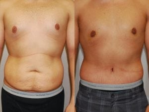 Before and After Image