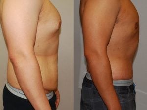 Before and After Image