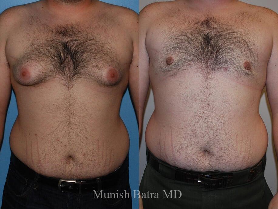 Before and After Image