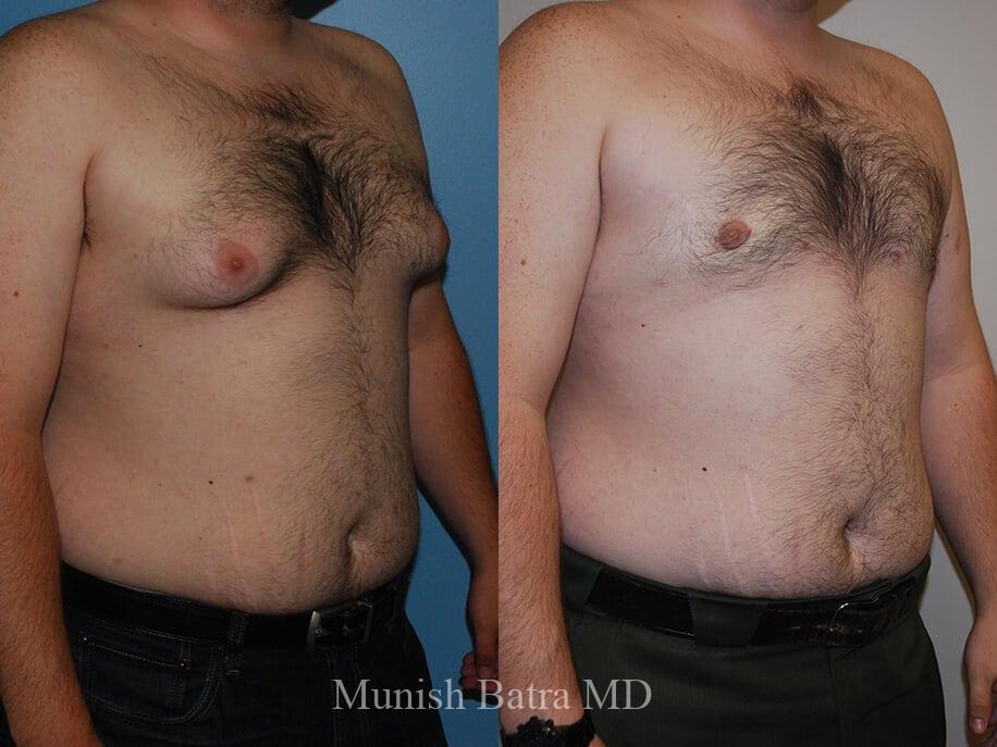 Before and After Image