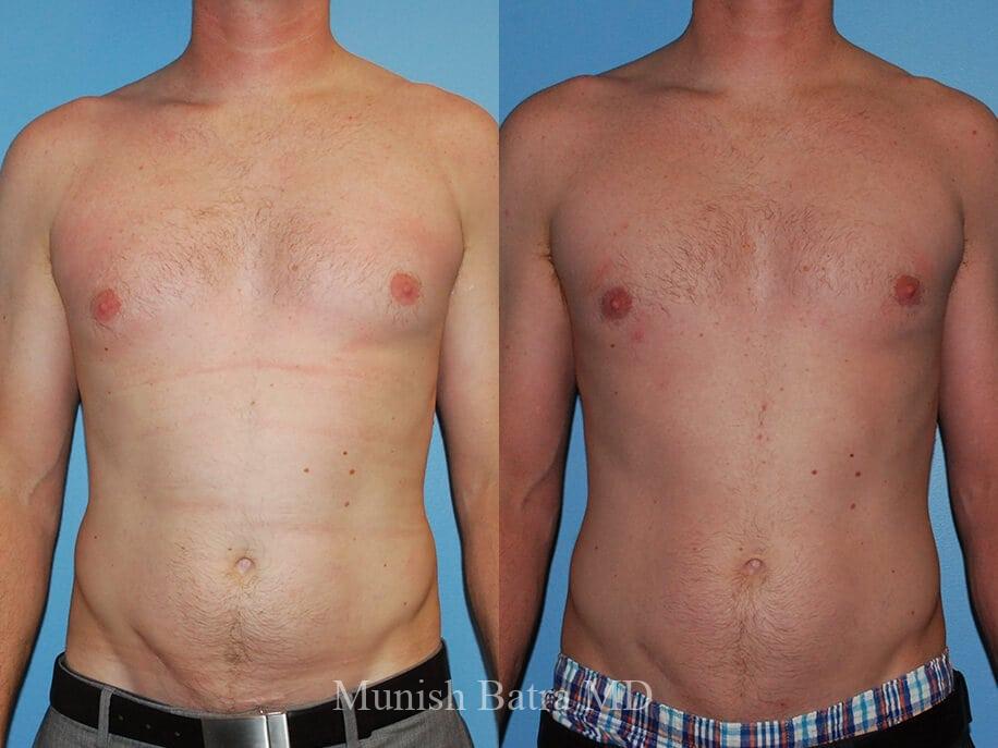 Before and After Image