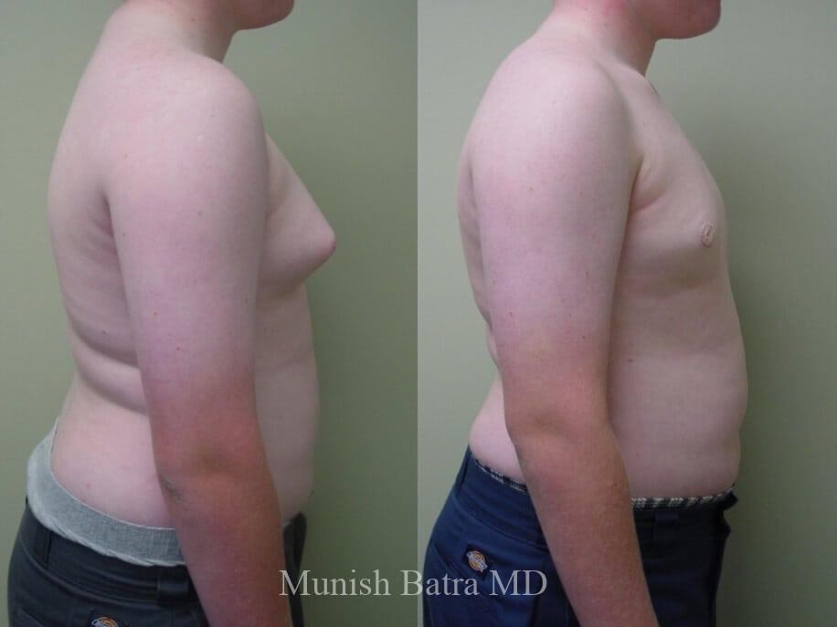 Before and After Image