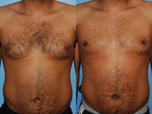 Before and After Image