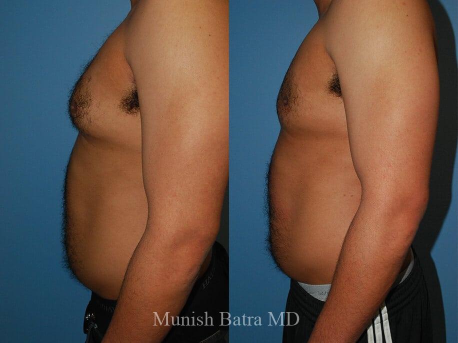 Before and After Image