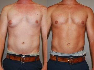 Before and After Image