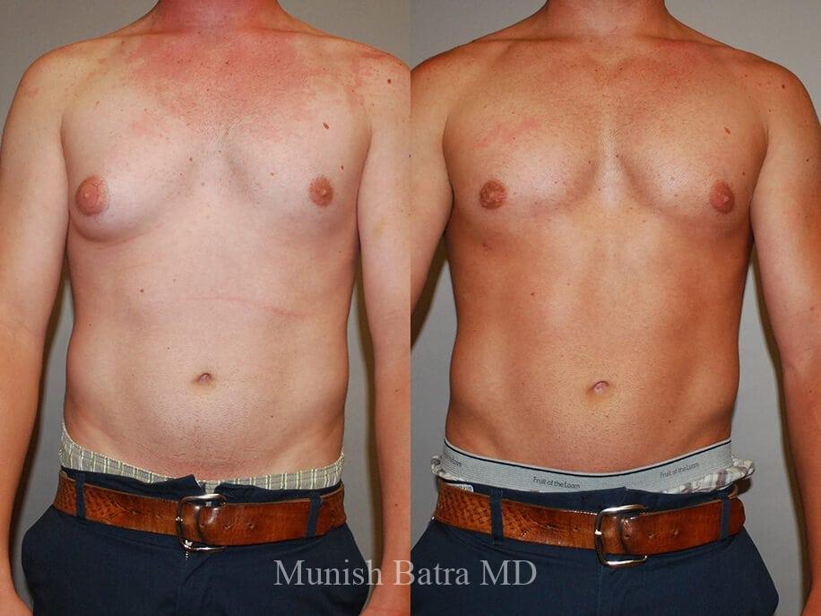Before and After Image