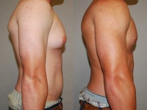 Before and After Image
