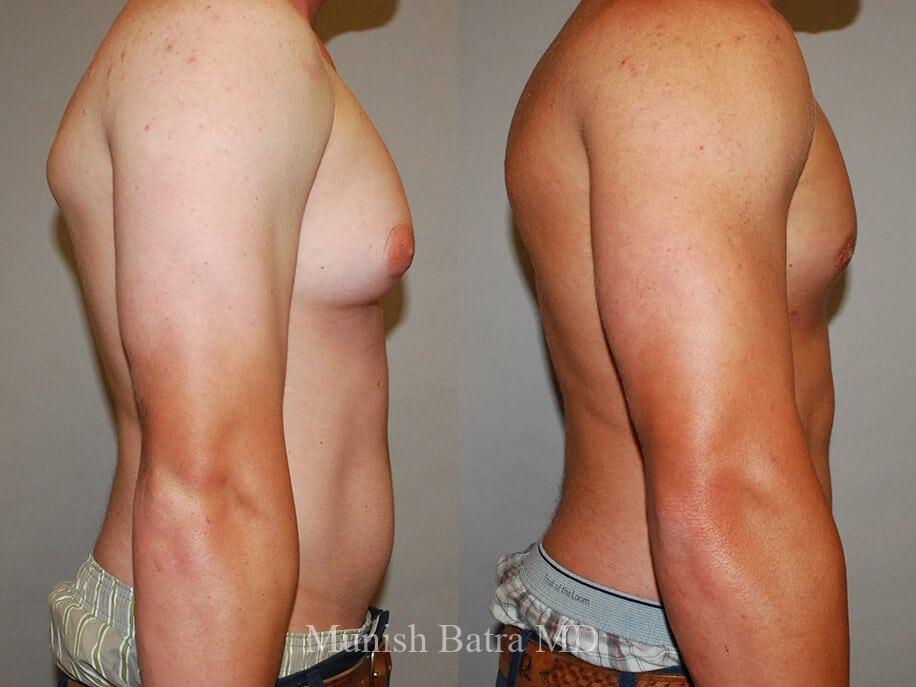 Before and After Image
