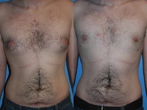 Before and After Image