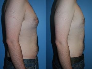 Before and After Image