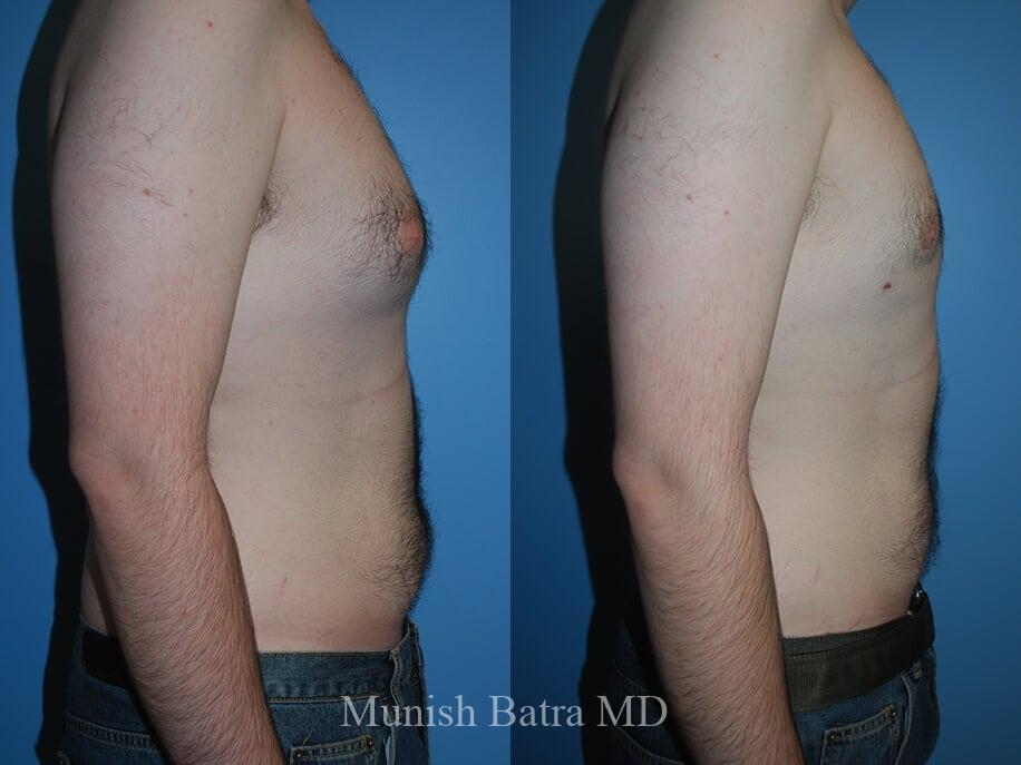 Before and After Image