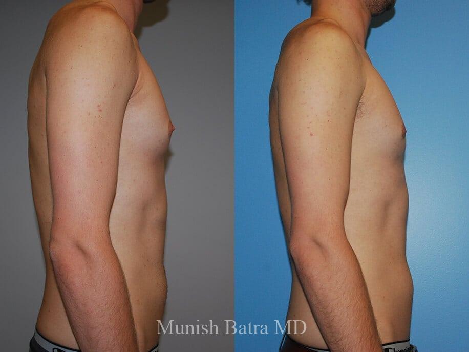 Before and After Image