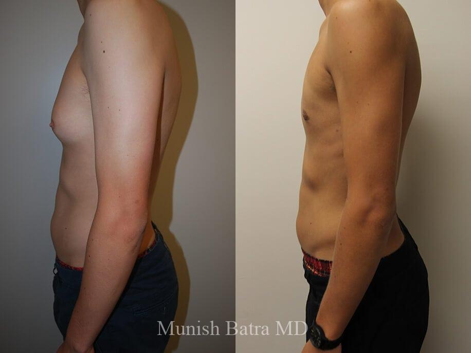 Before and After Image