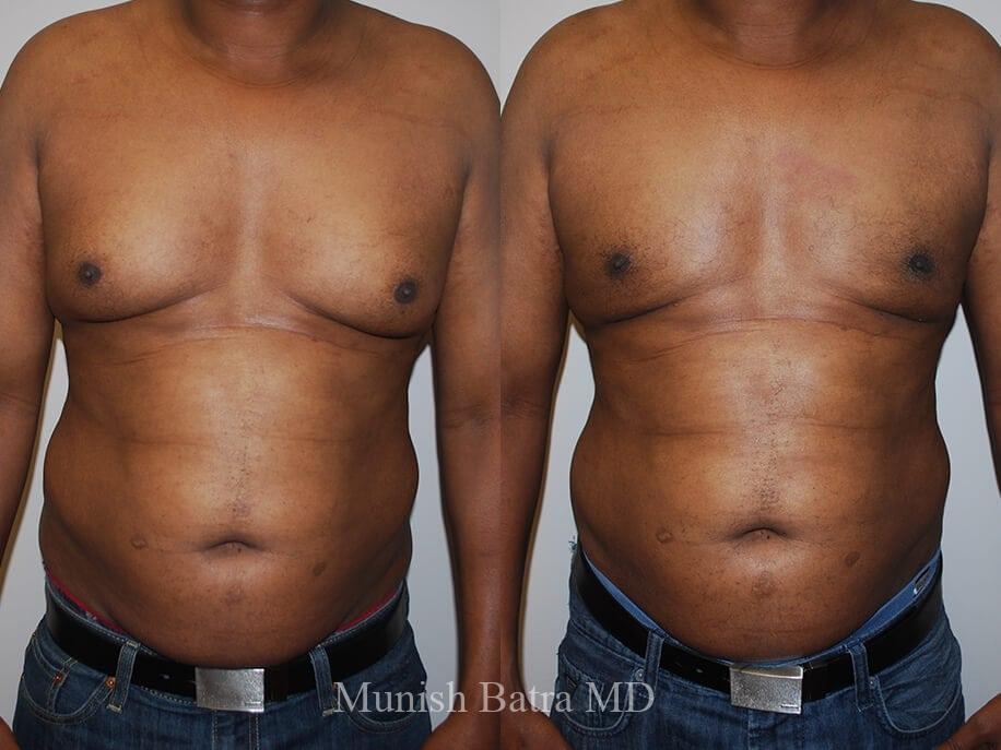 Before and After Image