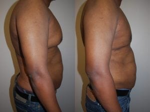 Before and After Image