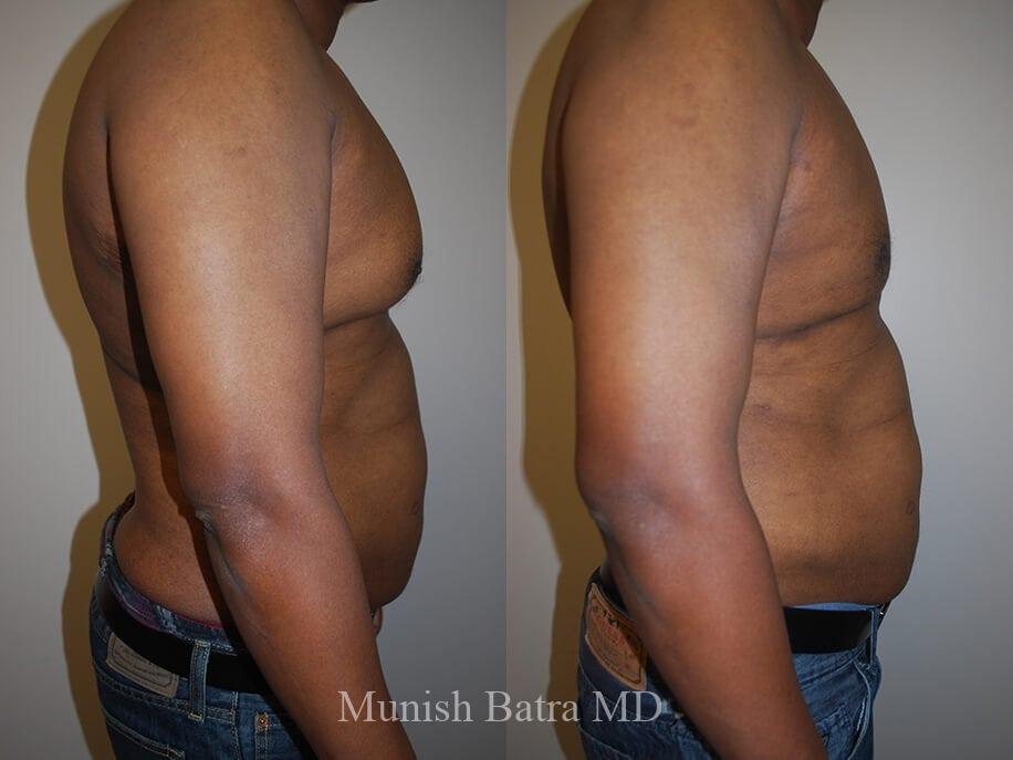 Before and After Image