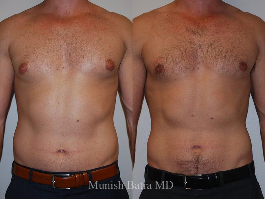 Before and After Image