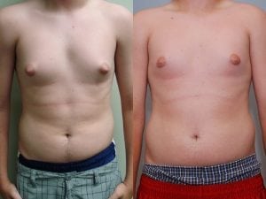 Before and After Image